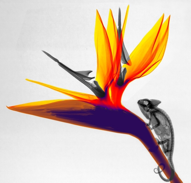 xray_2