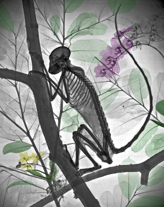 xray_8